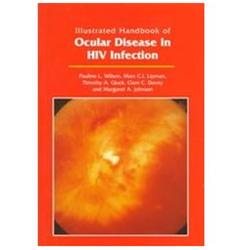 Illustrated Handbook of Ocular Disease in HIV Infection