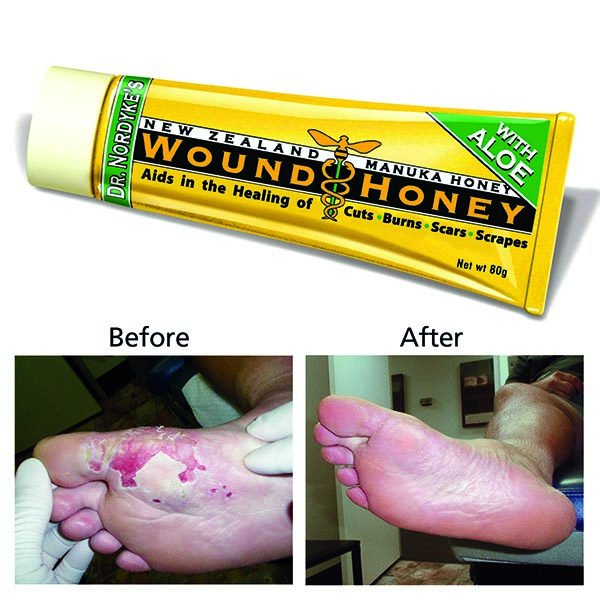Dr Nordyke's Manuka Wound Honey - 100% Organic Honey & Aloe for Cuts and Burns