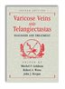 Varicose Veins And Telangiectasias: Diagnosis And Treatment