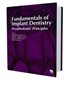 Fundamentals Of Implant Dentistry: Prosthodontic Principles (volume I)