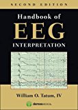 Handbook of EEG Interpretation, Second Edition