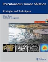 Percutaneous Tumor Ablation: Strategies And Techniques