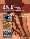 Disinfection of Root Canal Systems: The Treatment of Apical Periodontitis
